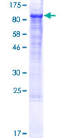 12.5% SDS-PAGE Stained with Coomassie Blue